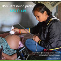 New arrival usb ultrasound probe for laptop in clinics, emergency and outdoor